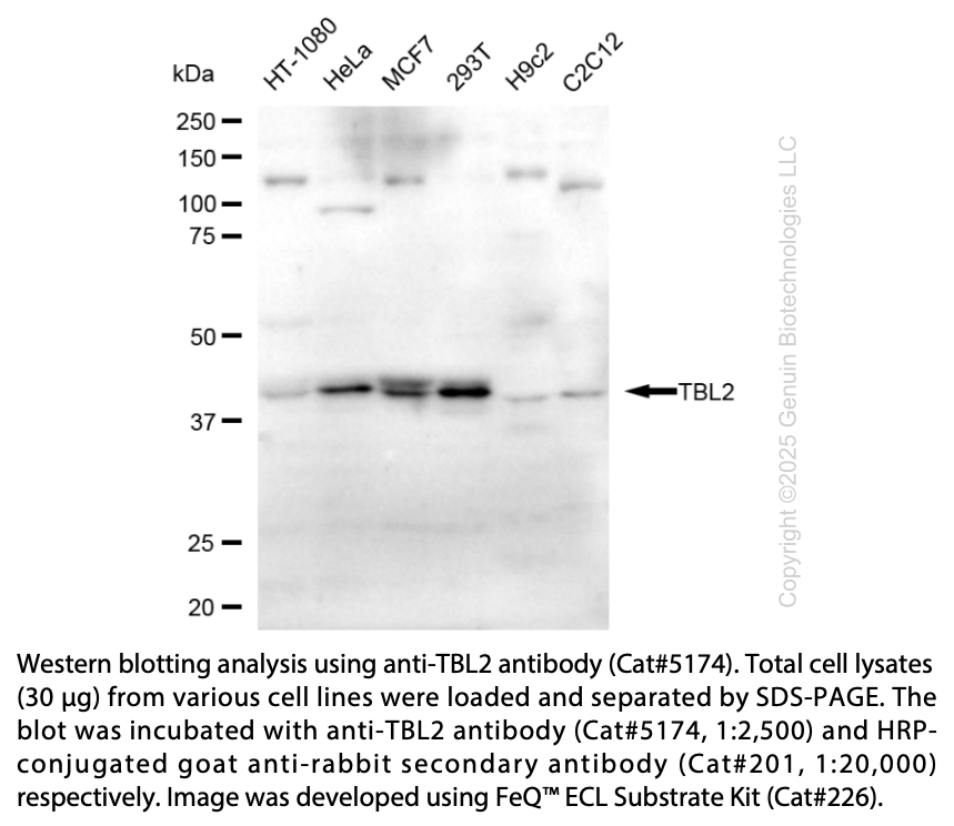 Anti-TBL2 Rabbit Polyclonal Ab #5174