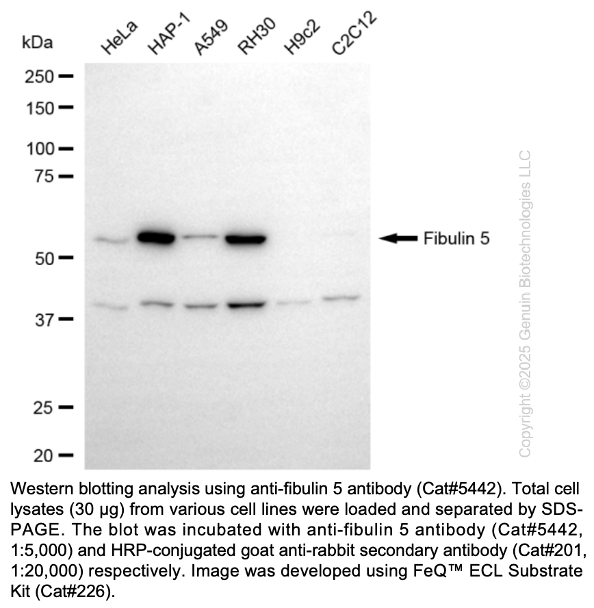Anti-Fibulin 5 Rabbit mAb #5442