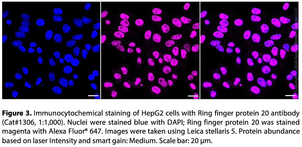 Thumbnail: Anti-Ring Finger Protein 20 Rabbit mAb #1306