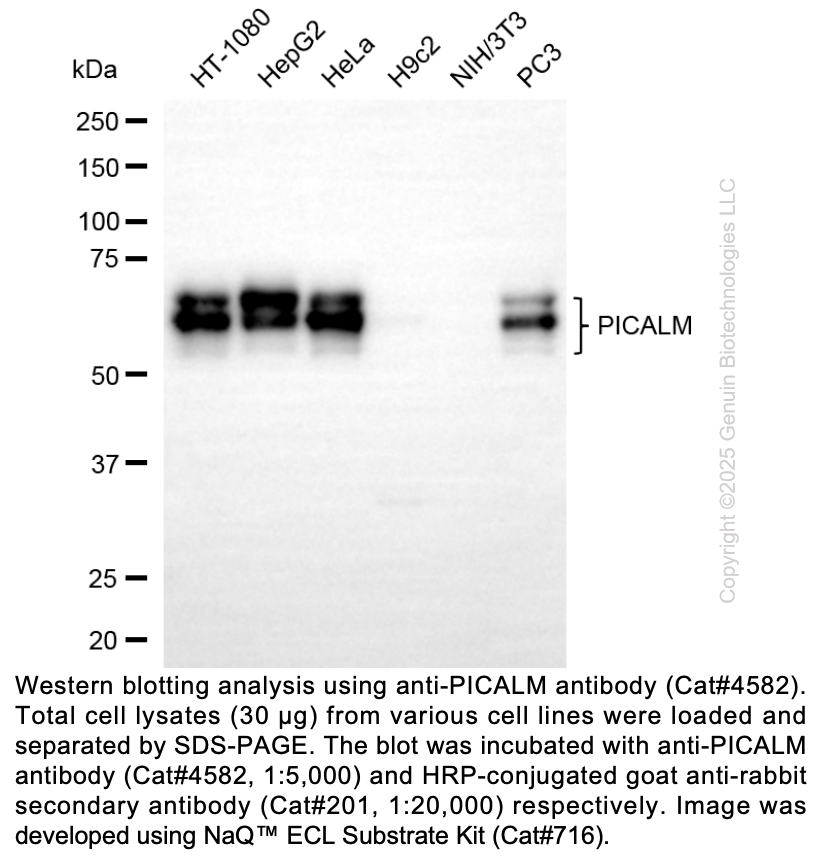 Anti-PICALM Rabbit Monoclonal Ab #4582