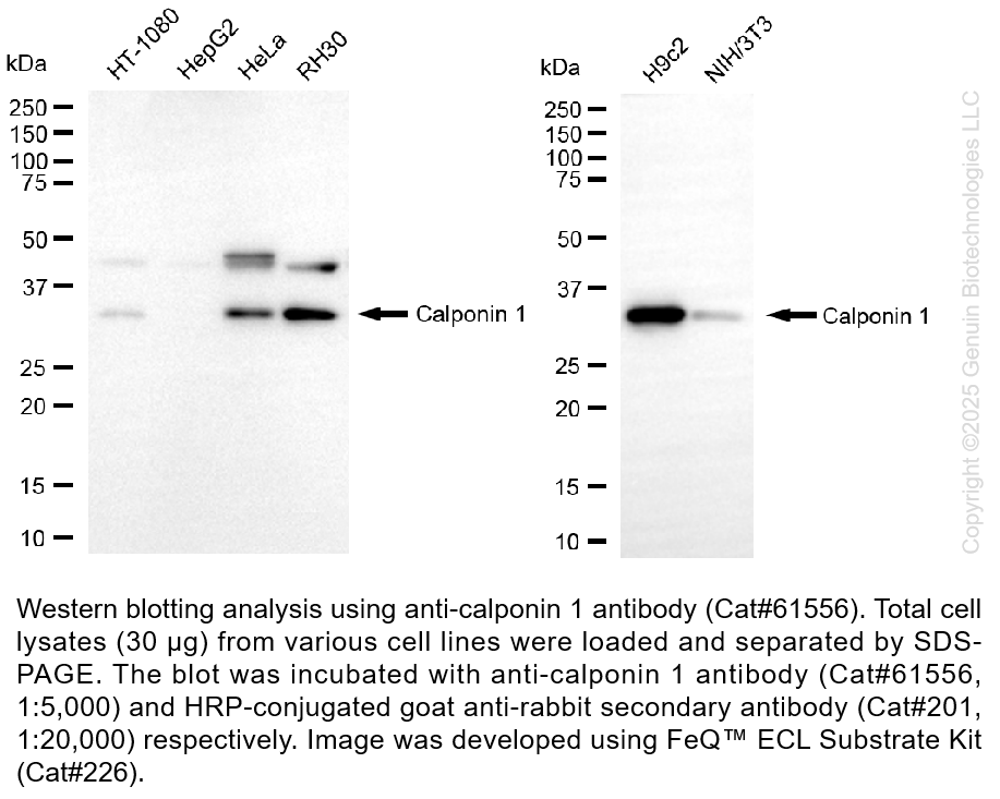 KD-Validated Anti-Calponin 1 Rabbit Monoclonal Ab #61556