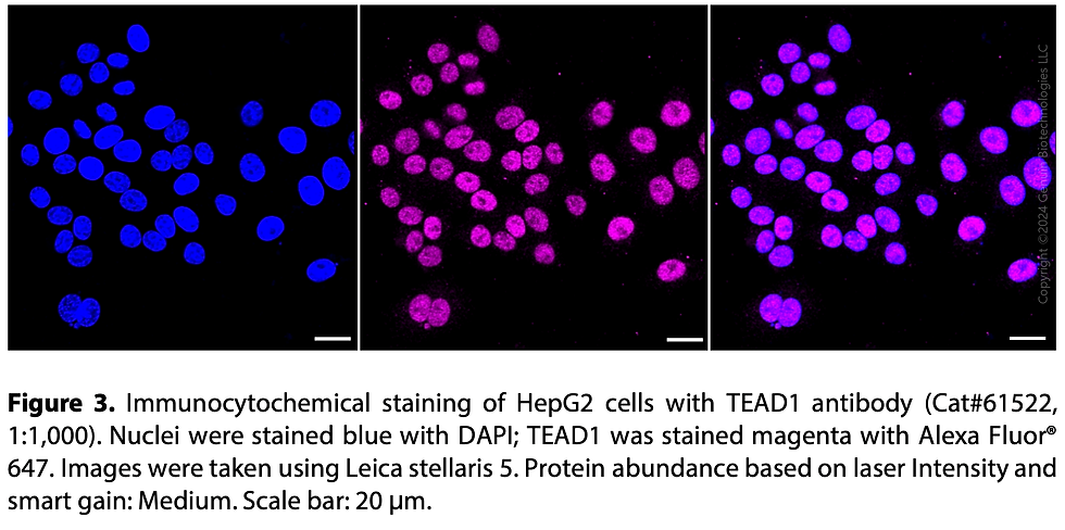Thumbnail: KD-Validated Anti-TEAD1 Rabbit Monoclonal Ab#61522