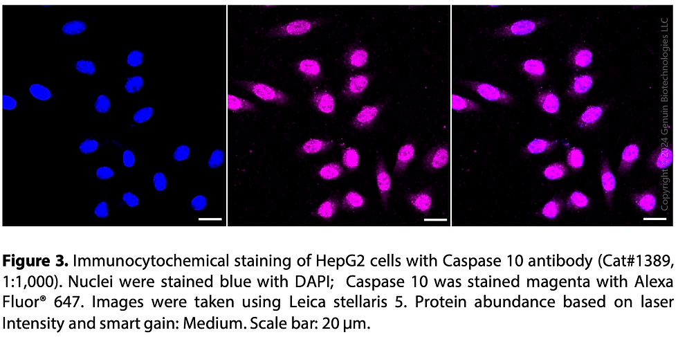 Thumbnail: Anti-Caspase 10 Rabbit mAb #1389