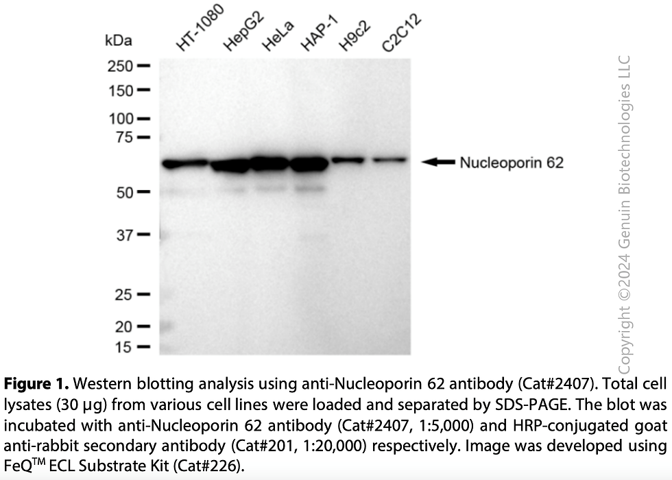 Thumbnail: Anti-Nucleoporin 62 Rabbit mAb #2407