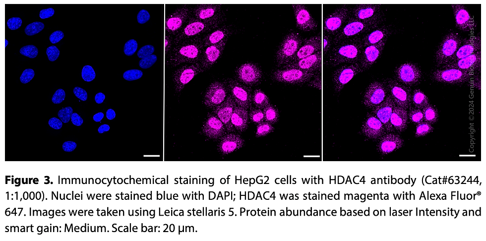 Thumbnail: KD-Validated Anti-HDAC4 Rabbit Monoclonal Ab#63244