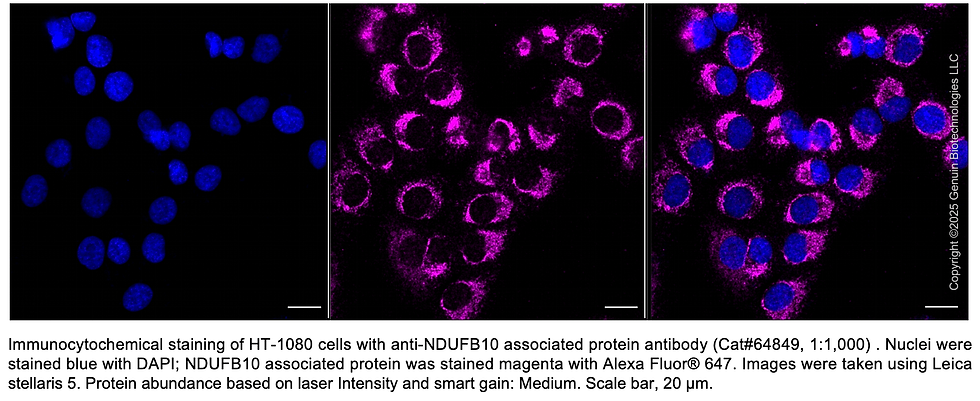 Thumbnail: KD-Validated Anti-NDUFB10 Mouse Monoclonal Ab #64849
