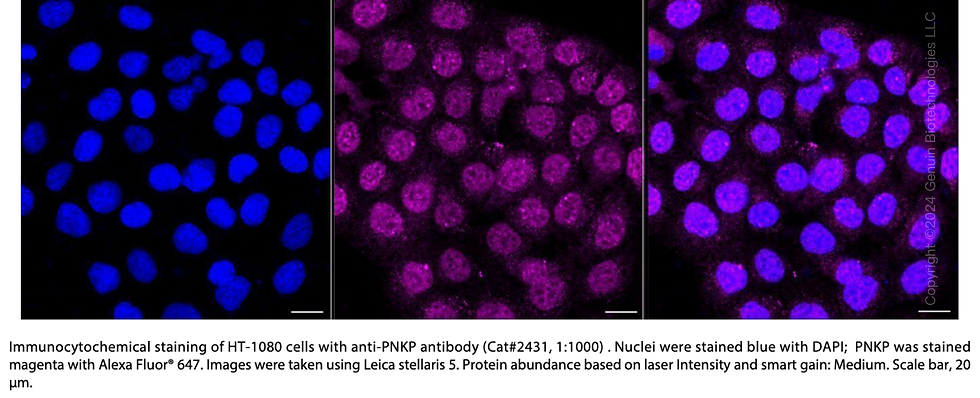 Thumbnail: Anti-PNK / PNKP Rabbit mAb #2431