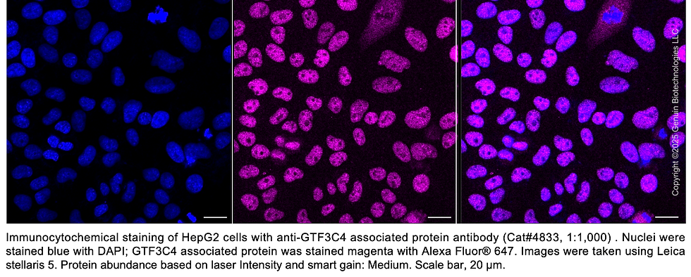 Thumbnail: Anti-GTF3C4 Mouse Monoclonal Ab #4833