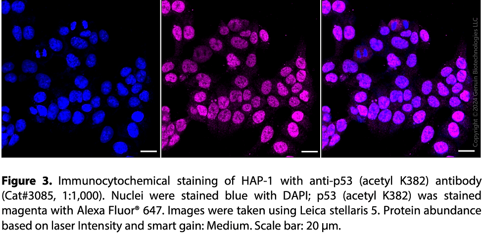 Thumbnail: Anti-p53 (Acetyl K382) Rabbit mAb #3085