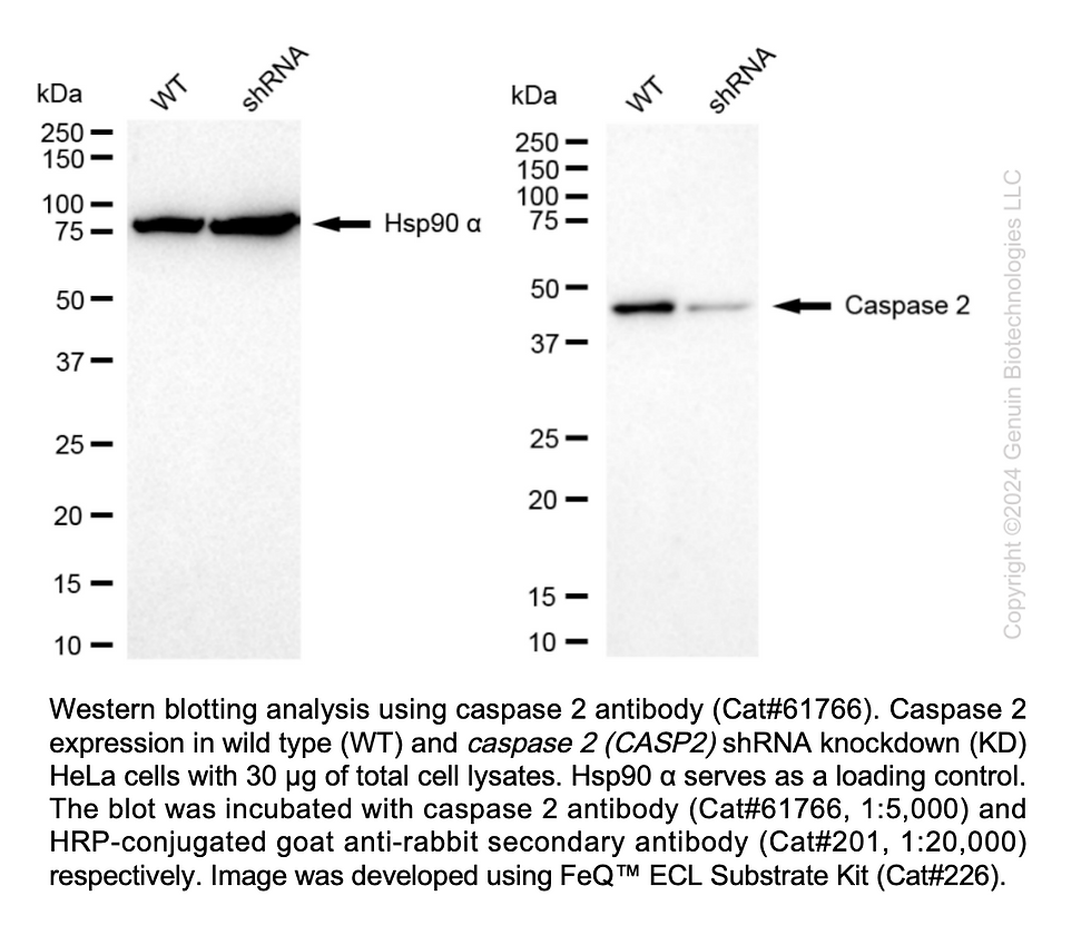 Thumbnail: KD-Validated Anti-Caspase 2 Rabbit Monoclonal Ab#61766