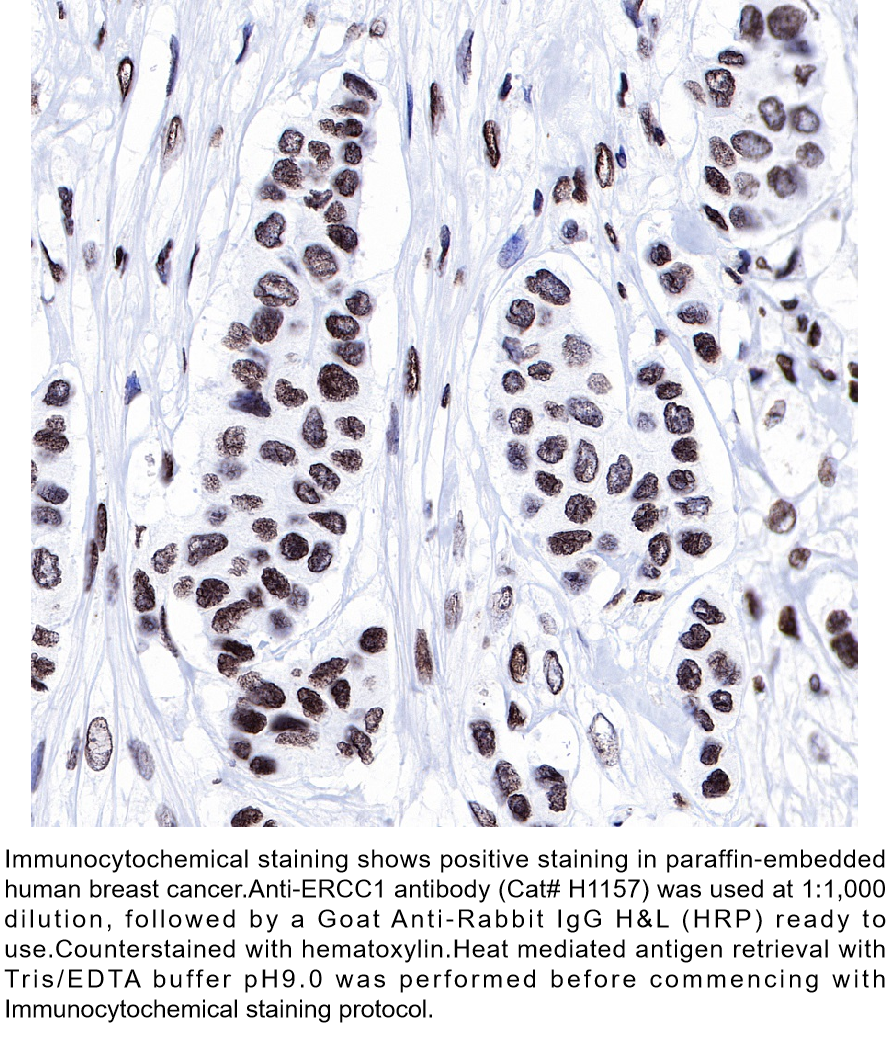 Anti-ERCC1 Rabbit Monoclonal Ab #H1157