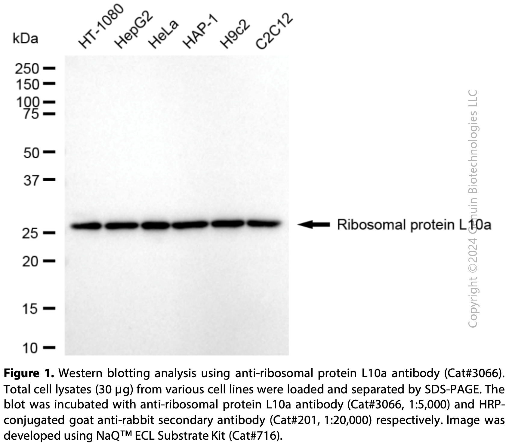 Anti-Ribosomal Protein L10a Rabbit mAb #3066