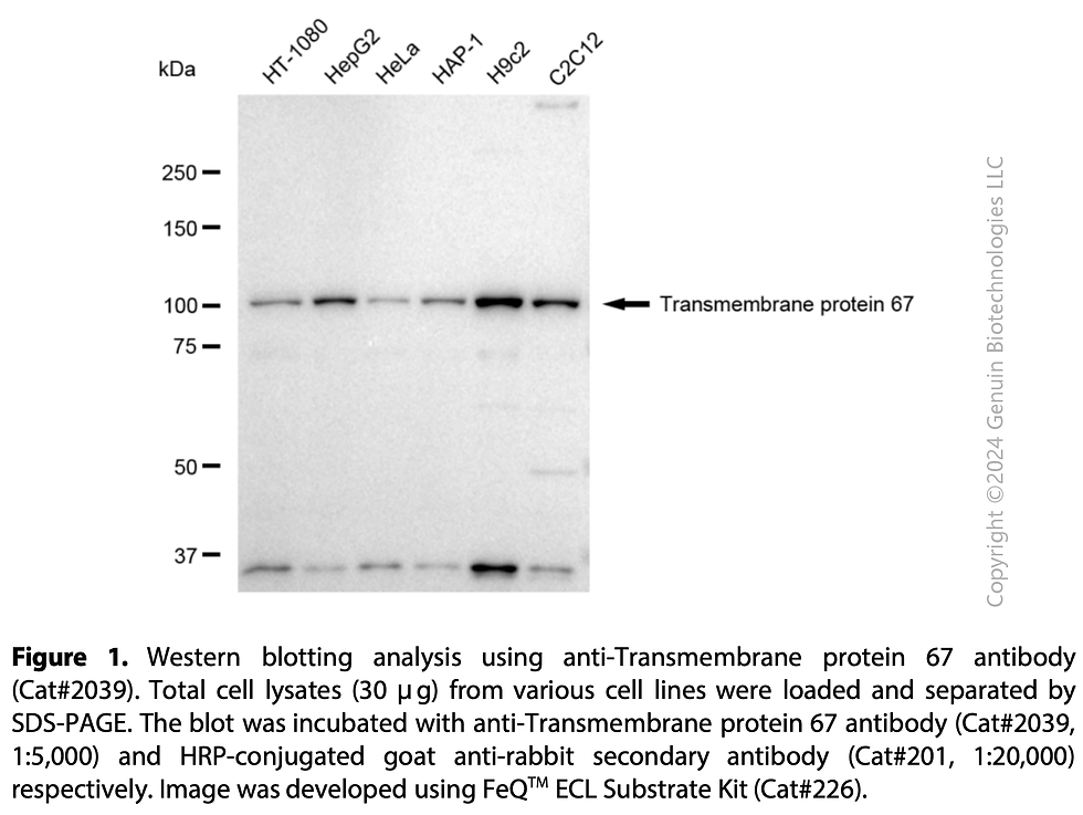 Thumbnail: Anti-Transmembrane Protein 67 Rabbit mAb #2039