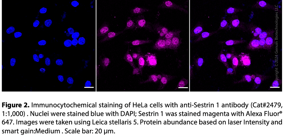 Thumbnail: Anti-Sestrin 1 Rabbit mAb #2479
