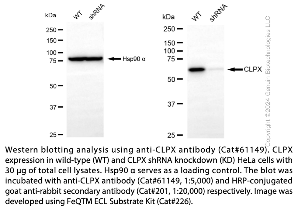 Thumbnail: KD-Validated Anti-CLPX Rabbit Monoclonal Ab #61149