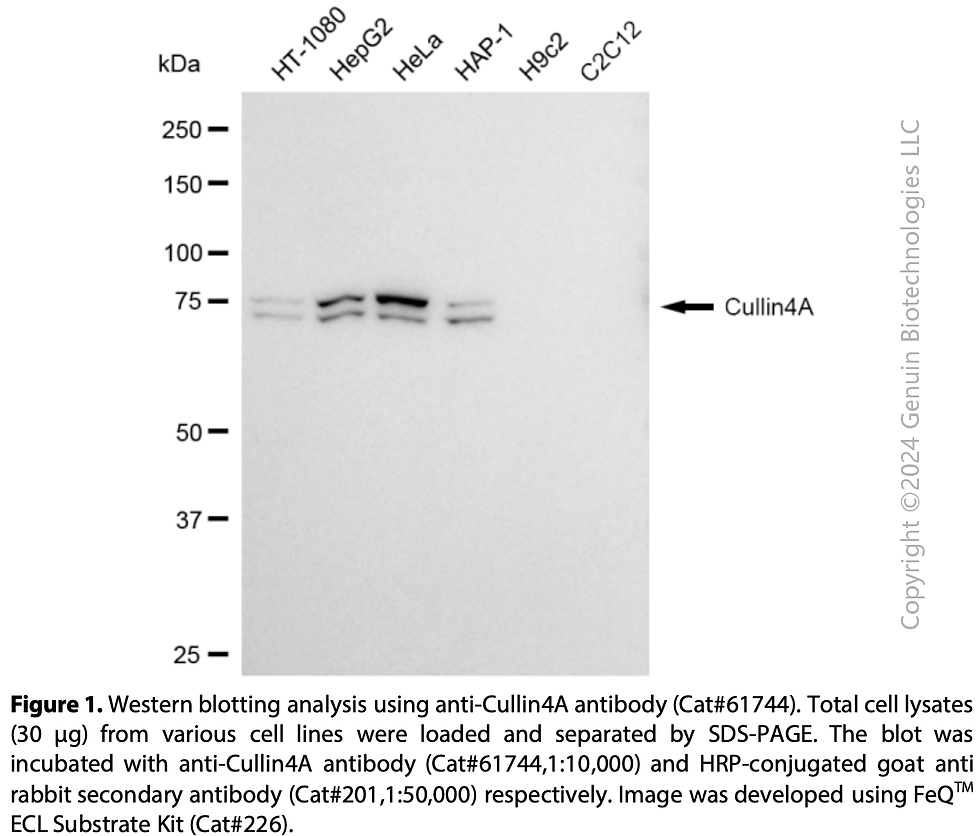 Thumbnail: KD-Validated Anti-Cullin4A Rabbit Monoclonal Ab#61744