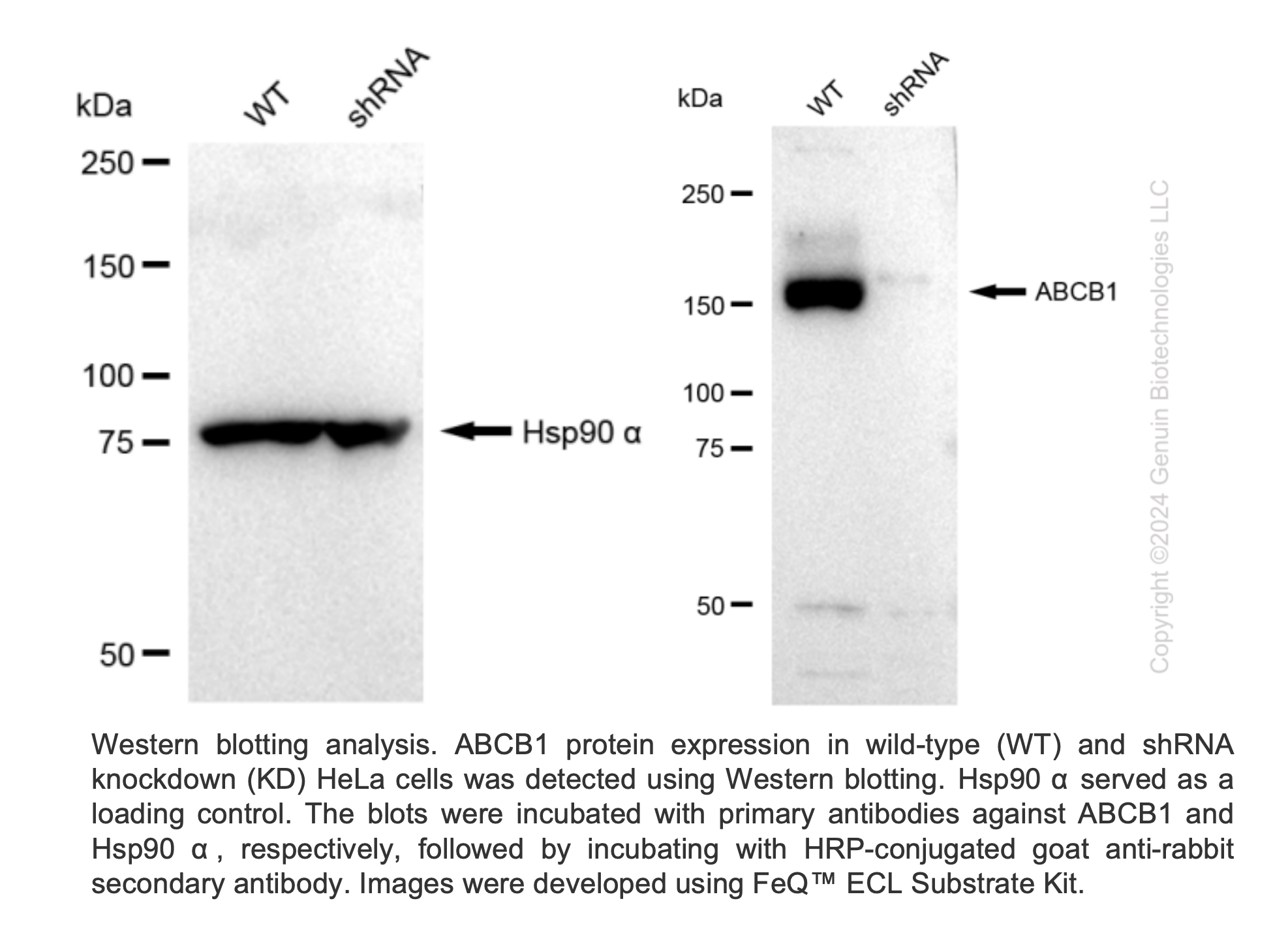 WB-Validated ABCB1 Lentiviral shRNA Knockdown Kit #V61111