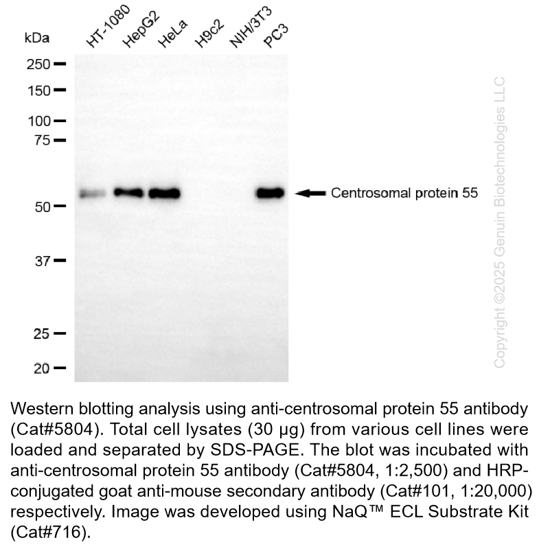 Anti-CEP55 Mouse Monoclonal Ab #5804