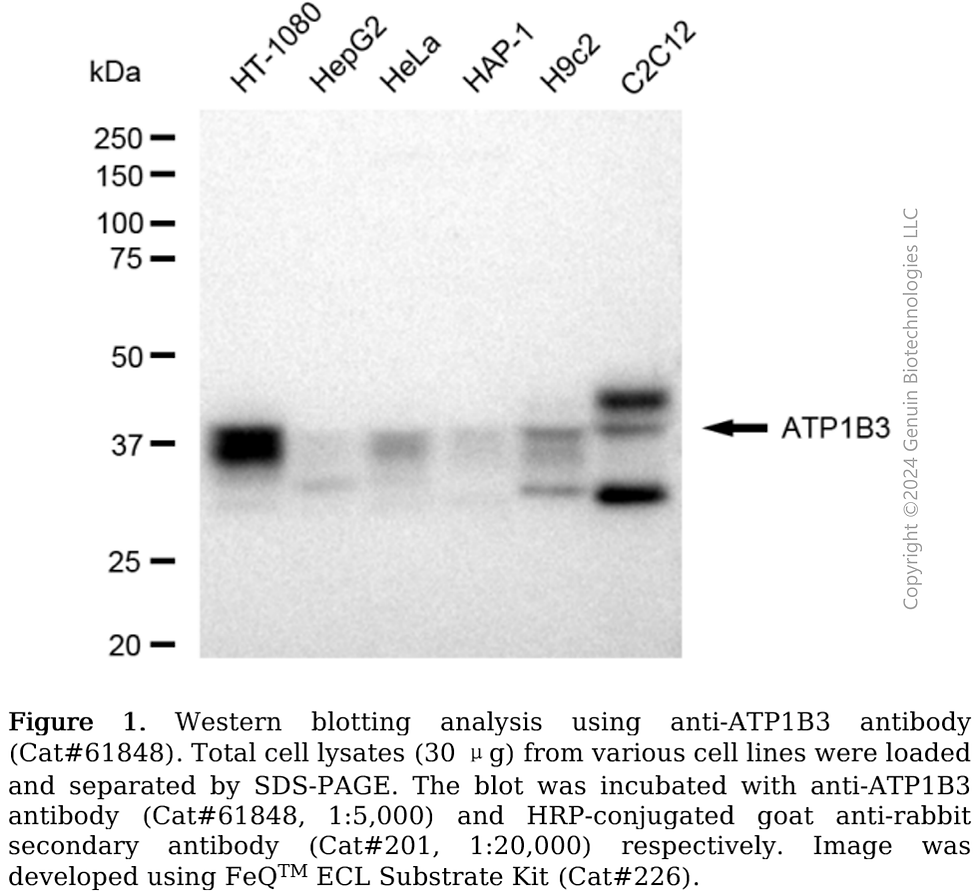 Thumbnail: KD-Validated Anti-ATP1B3 Rabbit Monoclonal Antibody#61848