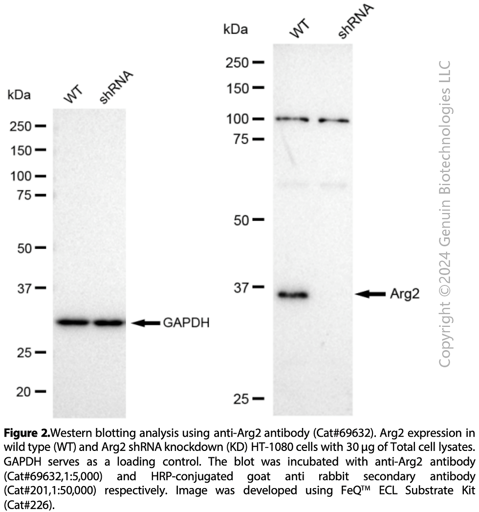 Thumbnail: KD-Validated Anti-Arg2 Rabbit Monoclonal Ab#69632