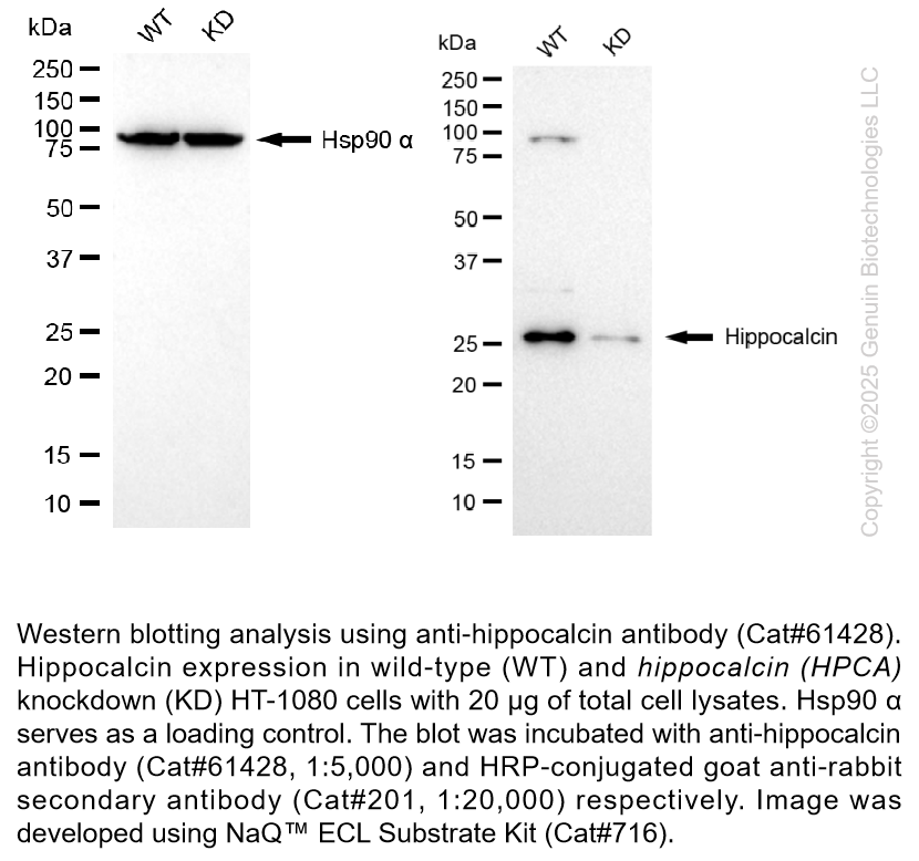 Thumbnail: KD-Validated Anti-Hippocalcin Rabbit mAb #61428