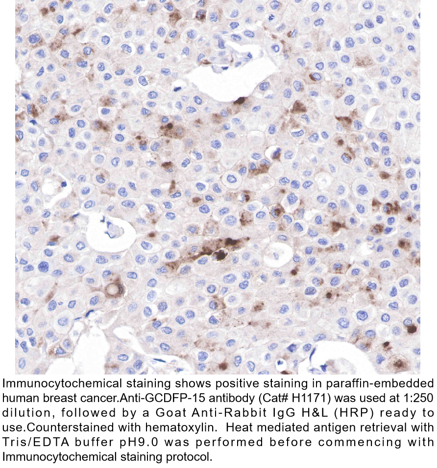 Thumbnail: Anti-GCDFP-15 Rabbit Monoclonal Ab #H1171