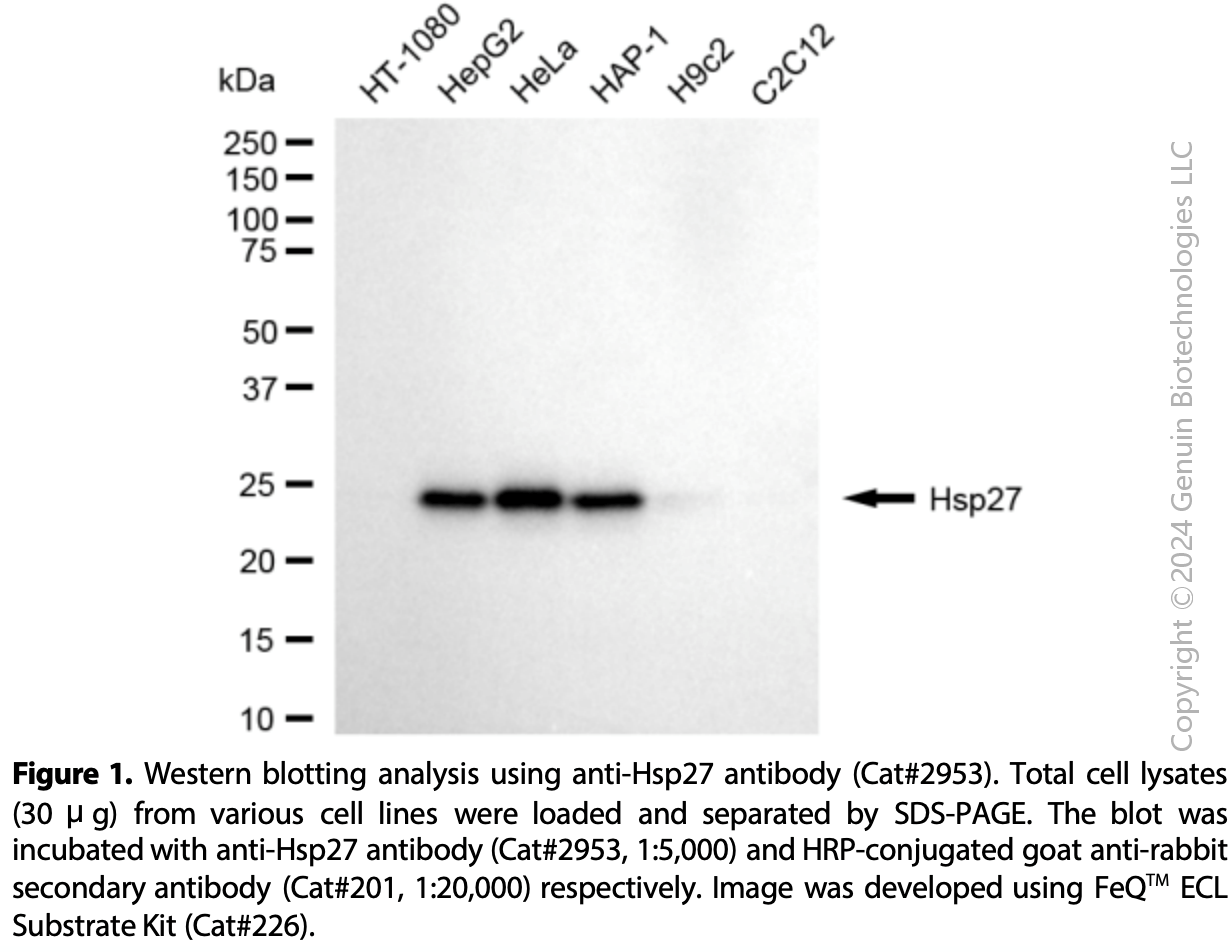 Anti-HSPB1 Rabbit mAb #2953