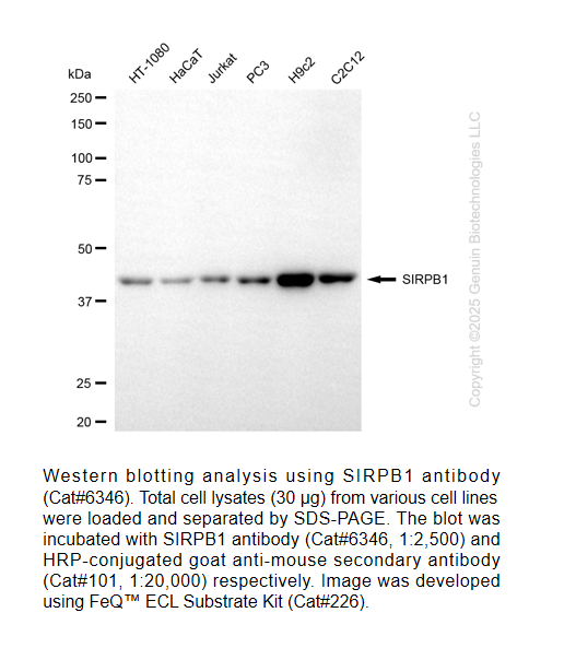 SIRPB1 Mouse mAb #6346