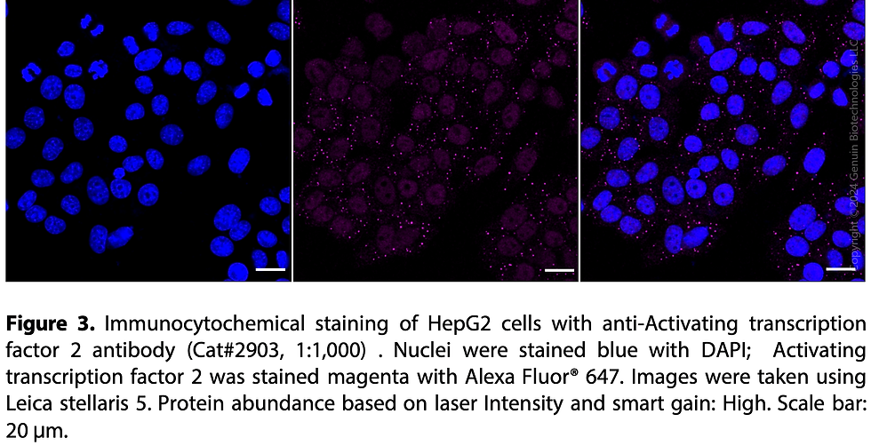 Thumbnail: Anti-Activating Transcription Factor 2 Rabbit mAb #2903