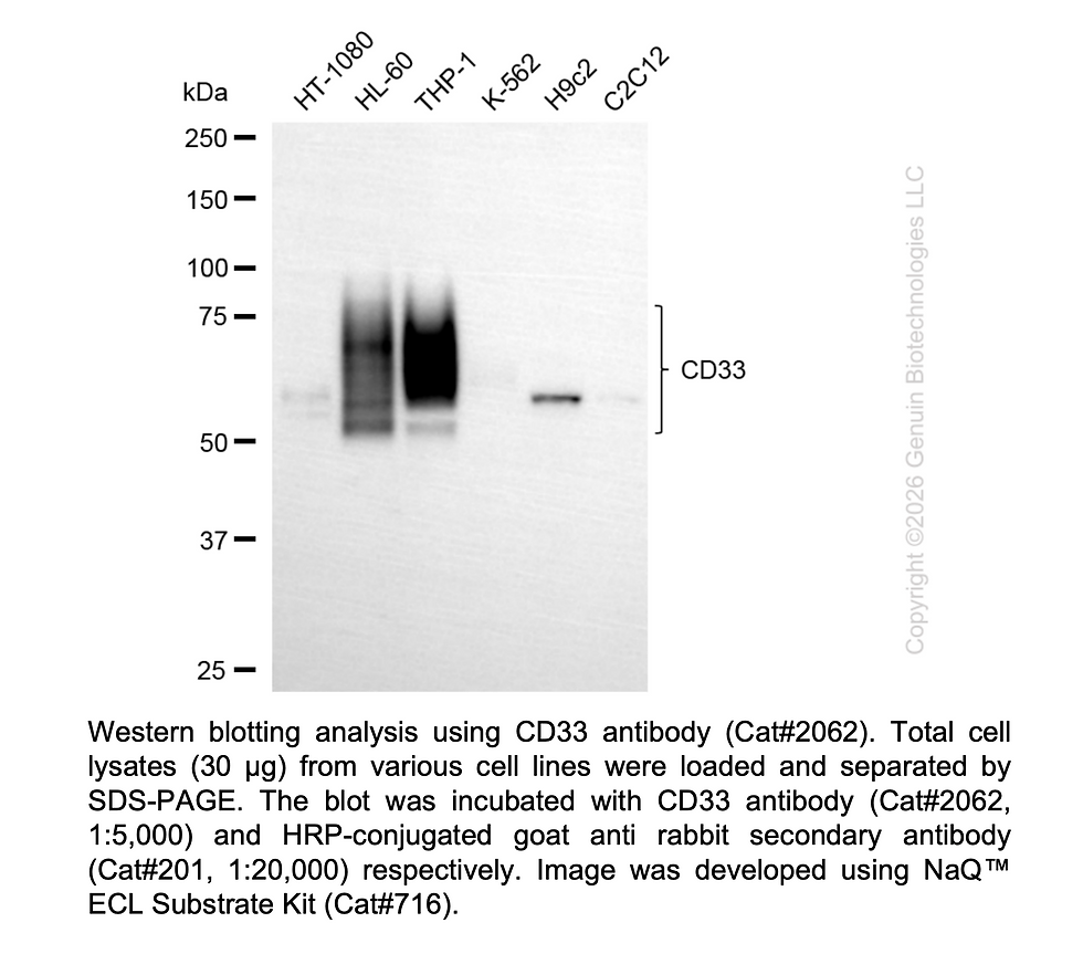 Thumbnail: Anti-CD33 Rabbit mAb #2062