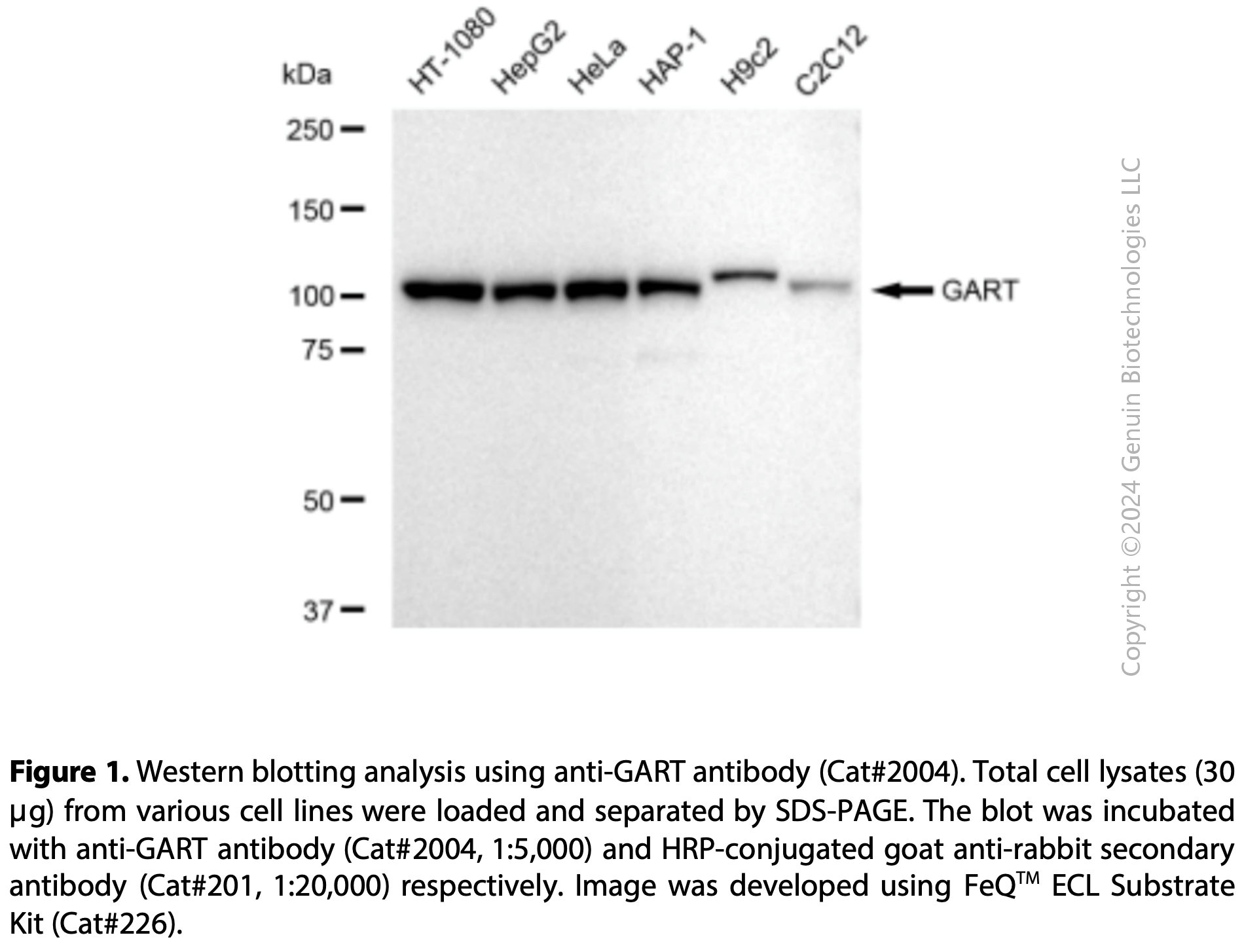 Anti-GART Rabbit mAb #2004