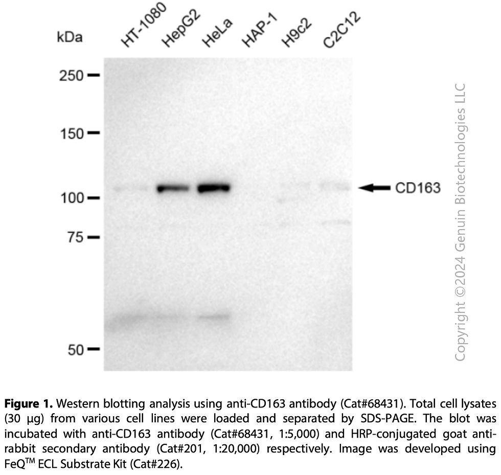 Thumbnail: KD-Validated Anti-CD163 Rabbit Monoclonal Ab#68431