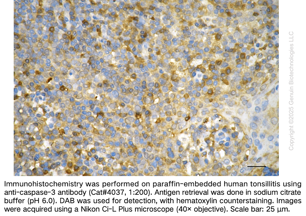 Thumbnail: Anti-Caspase 3 Rabbit Monoclonal Ab #4037