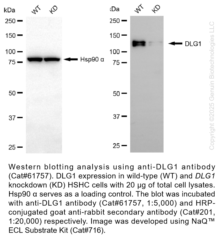 Thumbnail: KD-Validated Anti-DLG1 Rabbit Monoclonal Ab #61757