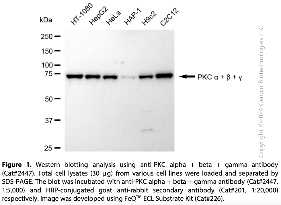 Anti-PKC alpha + beta + gamma Rabbit mAb #2447