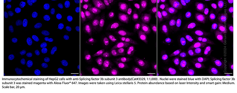 Thumbnail: Anti-Splicing Factor 3B Subunit 3 Rabbit Monoclonal Ab#3329