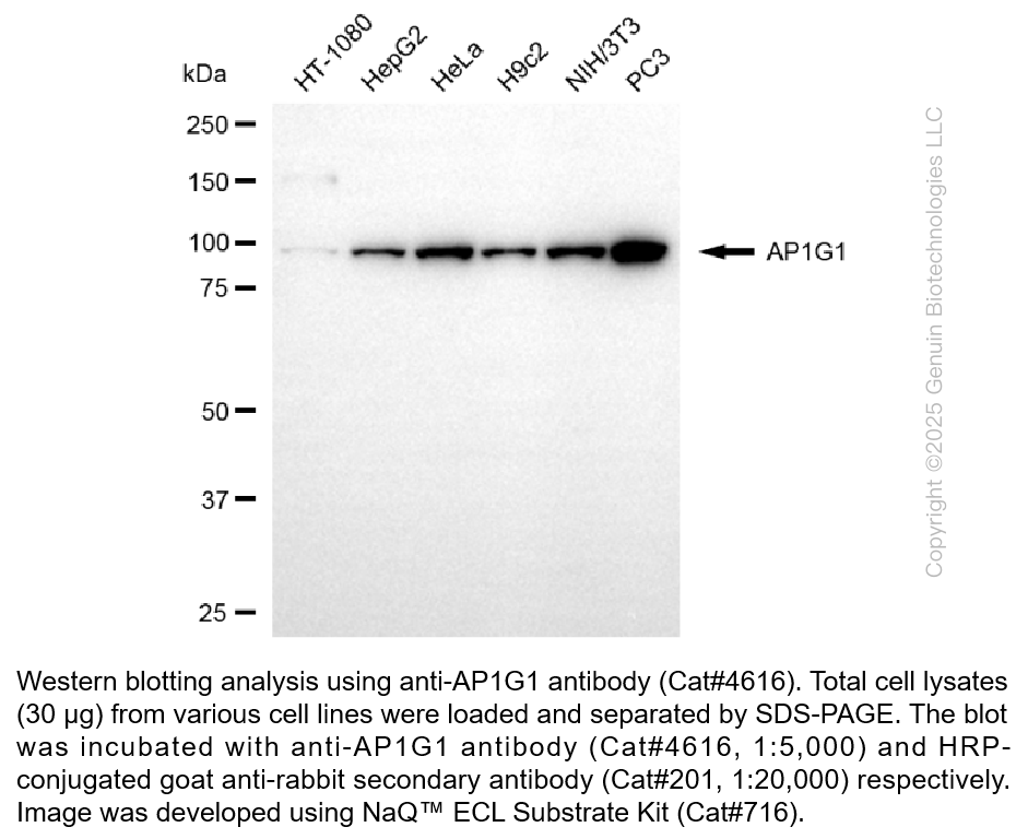 Anti-AP1G1 Rabbit Monoclonal Ab #4616