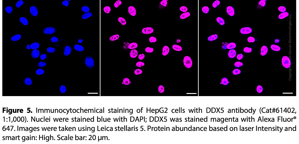 Thumbnail: KD-Validated Anti-DDX5 Rabbit Monoclonal Ab#61402