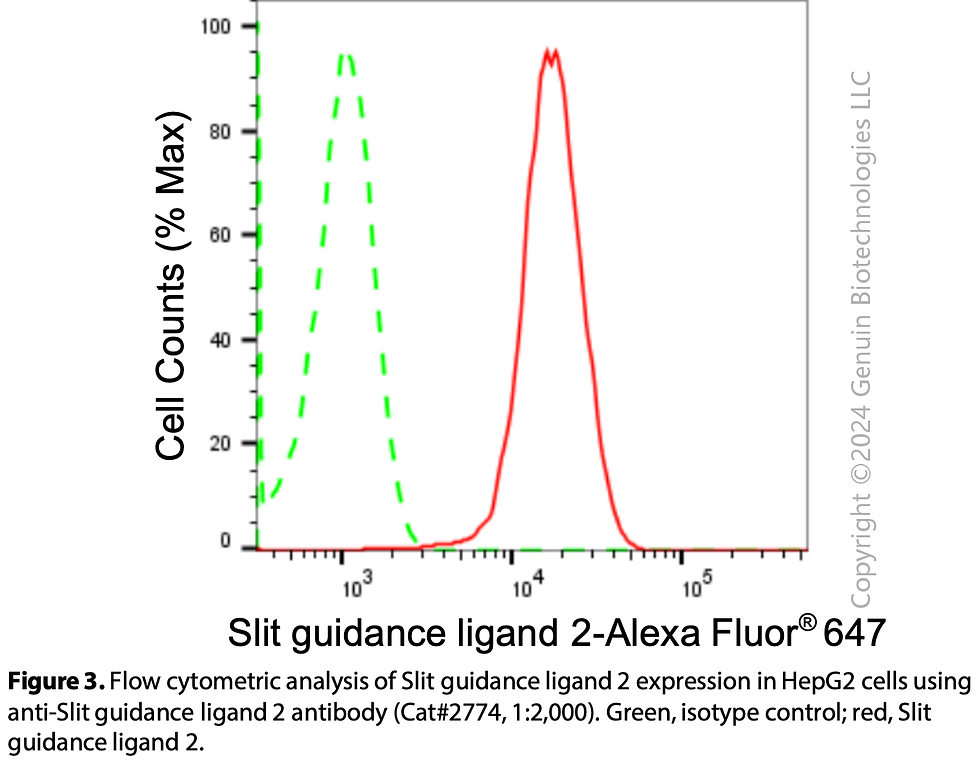 Thumbnail: Anti-Slit Guidance Ligand 2 Rabbit mAb #2774