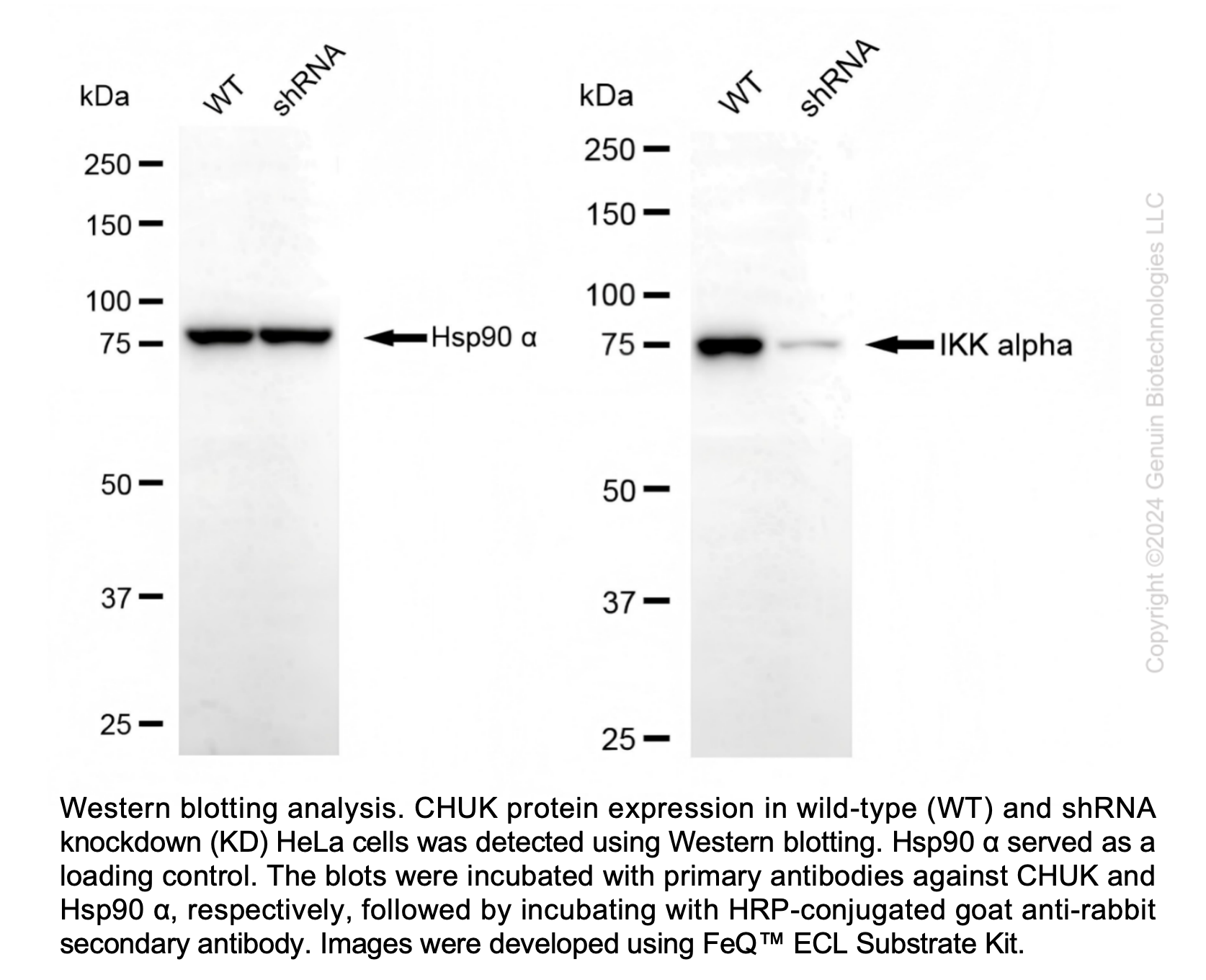 WB-Validated CHUK Knockdown Cell Lysate Kit#L1374