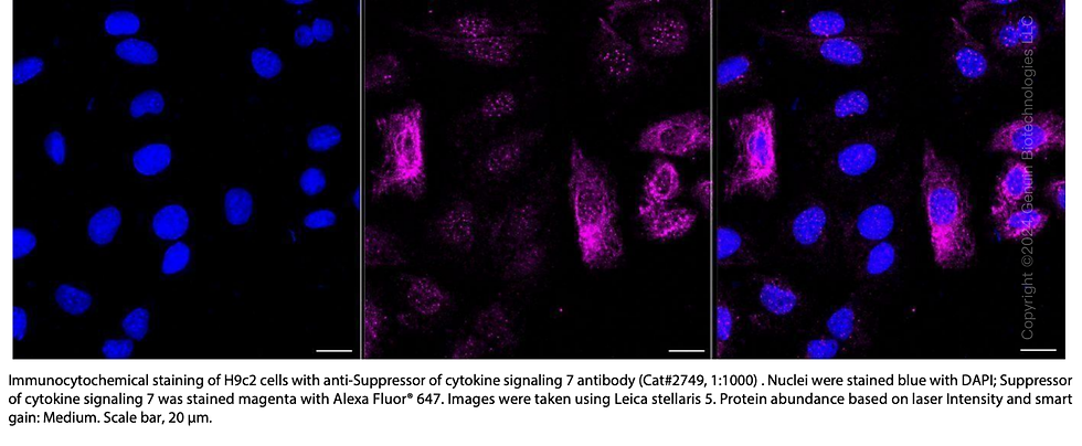 Thumbnail: Anti-Suppressor Of Cytokine Signaling 7 Rabbit mAb #2749