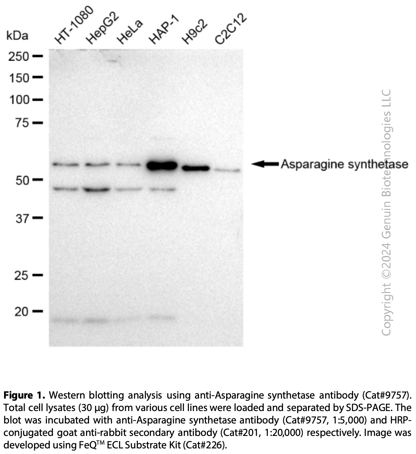 Anti-Asparagine Synthetase Rabbit mAb #9757