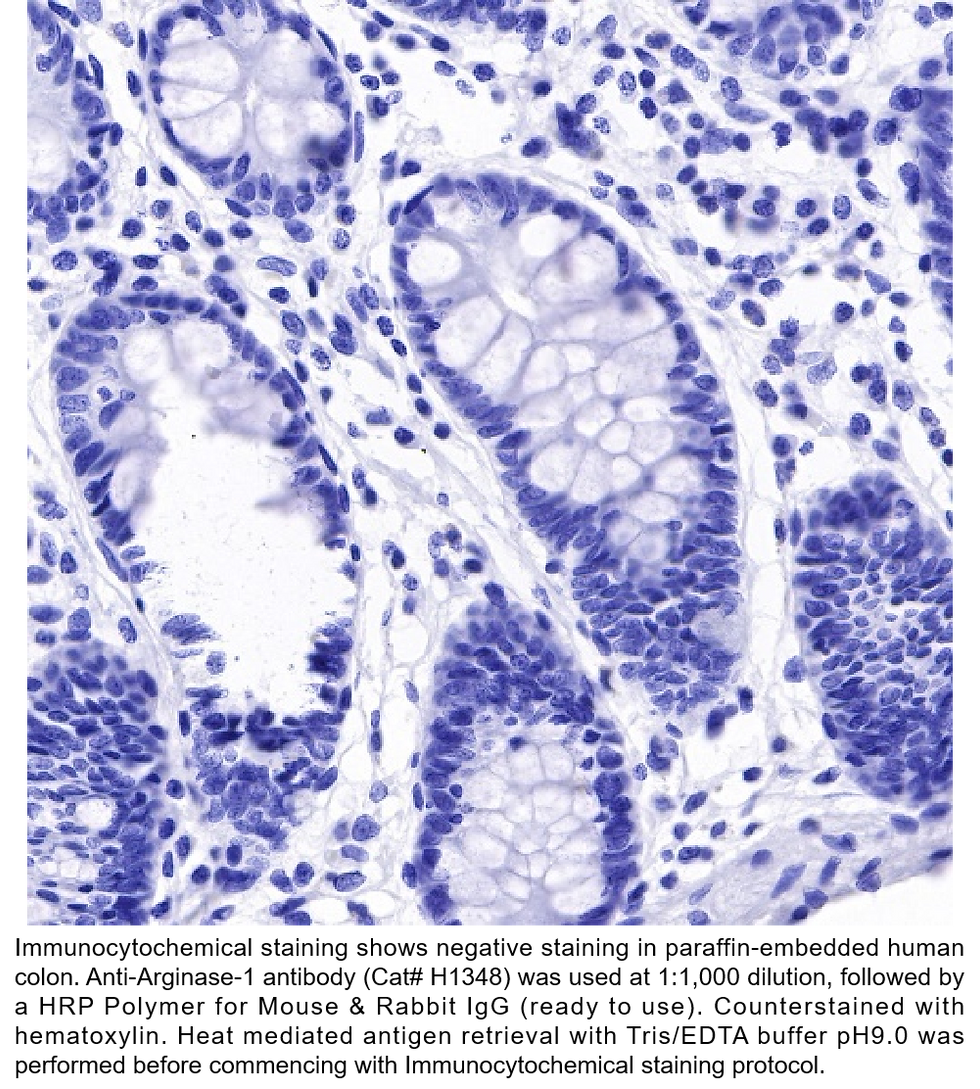 Thumbnail: Anti-Arginase-1 Rabbit Monoclonal Ab #H1348