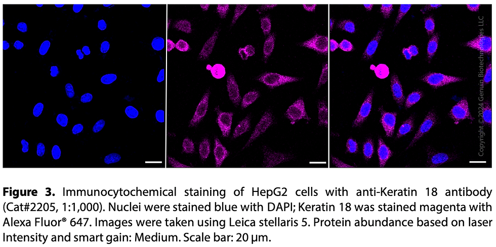 Thumbnail: Anti-Keratin 18 Rabbit mAb #2205
