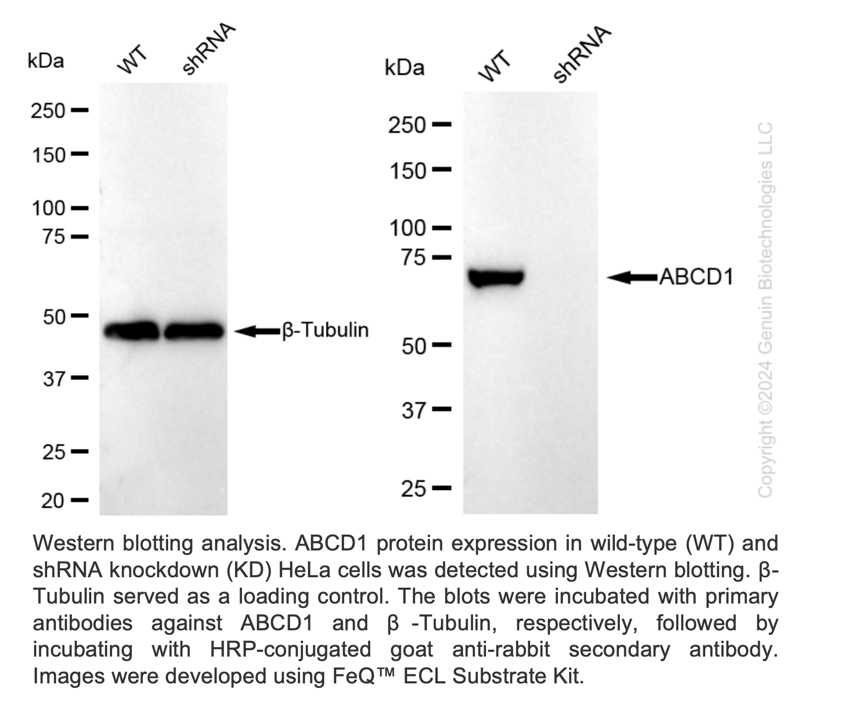 WB-Validated ABCD1 Lentiviral shRNA Knockdown Kit #V61364