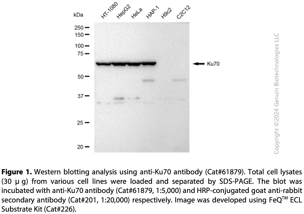 Thumbnail: KD-Validated Anti-Ku70 Rabbit mAb#61879