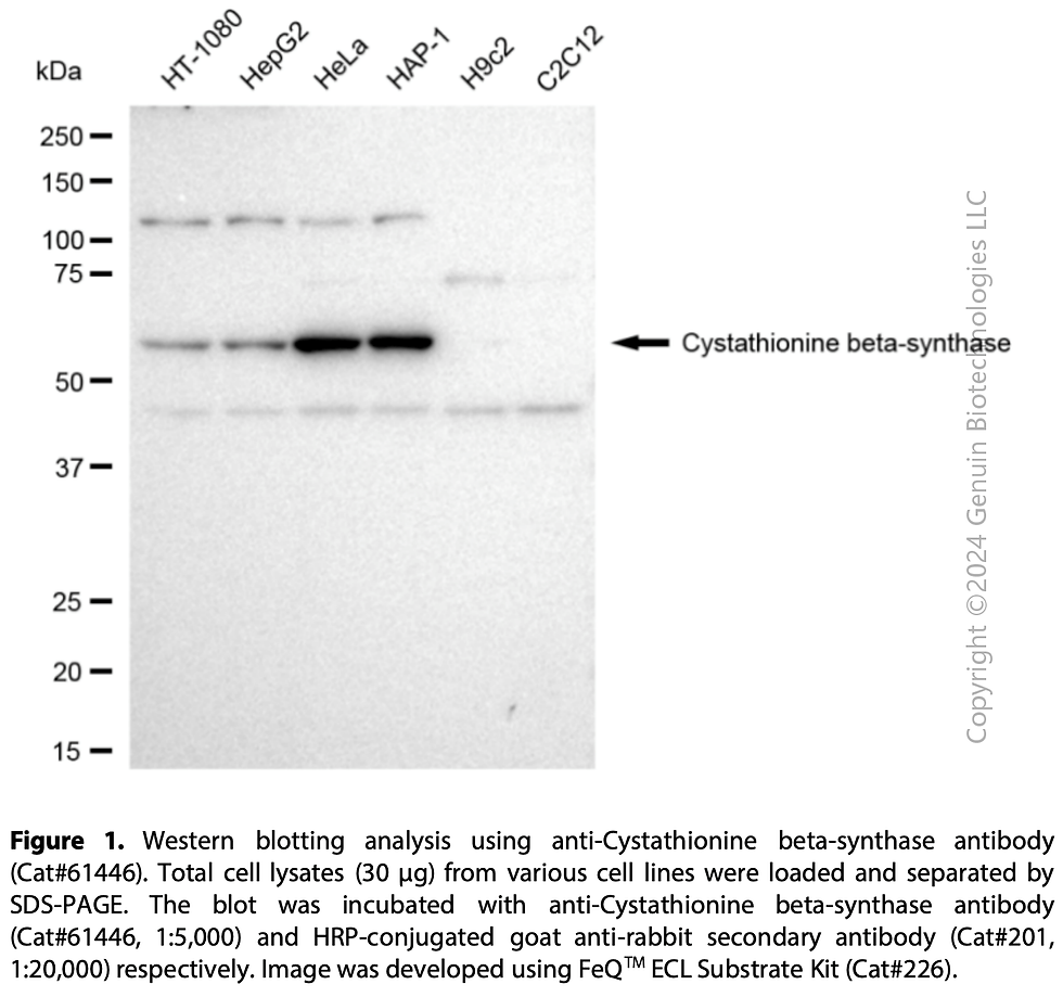 Thumbnail: KD-Validated Anti-Cystathionine Beta-Synthase Rabbit Monoclonal Ab#61446