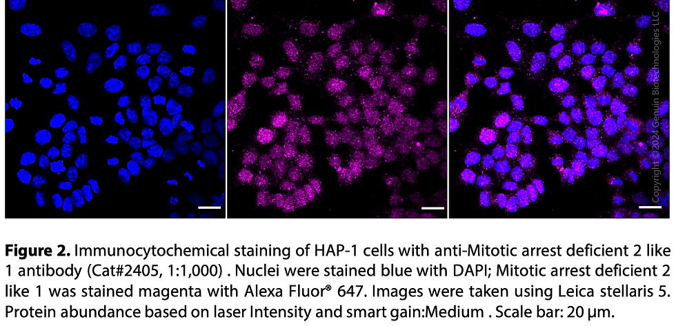Thumbnail: Anti-Mitotic Arrest Deficient 2 Like 1 Rabbit mAb #2405