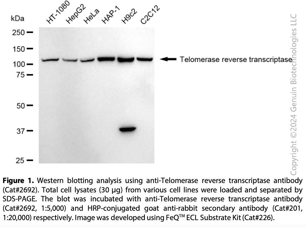 Thumbnail: Anti-Telomerase Reverse Transcriptase Rabbit mAb #2692