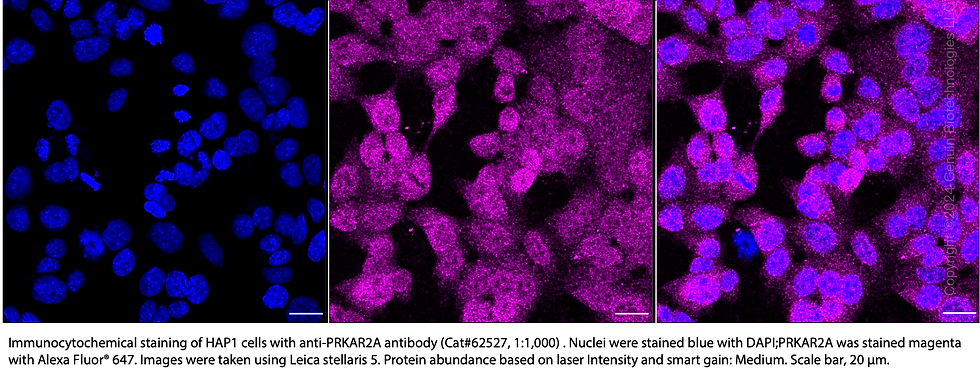 Thumbnail: KD-Validated Anti-PRKAR2A Rabbit Monoclonal Ab#62527